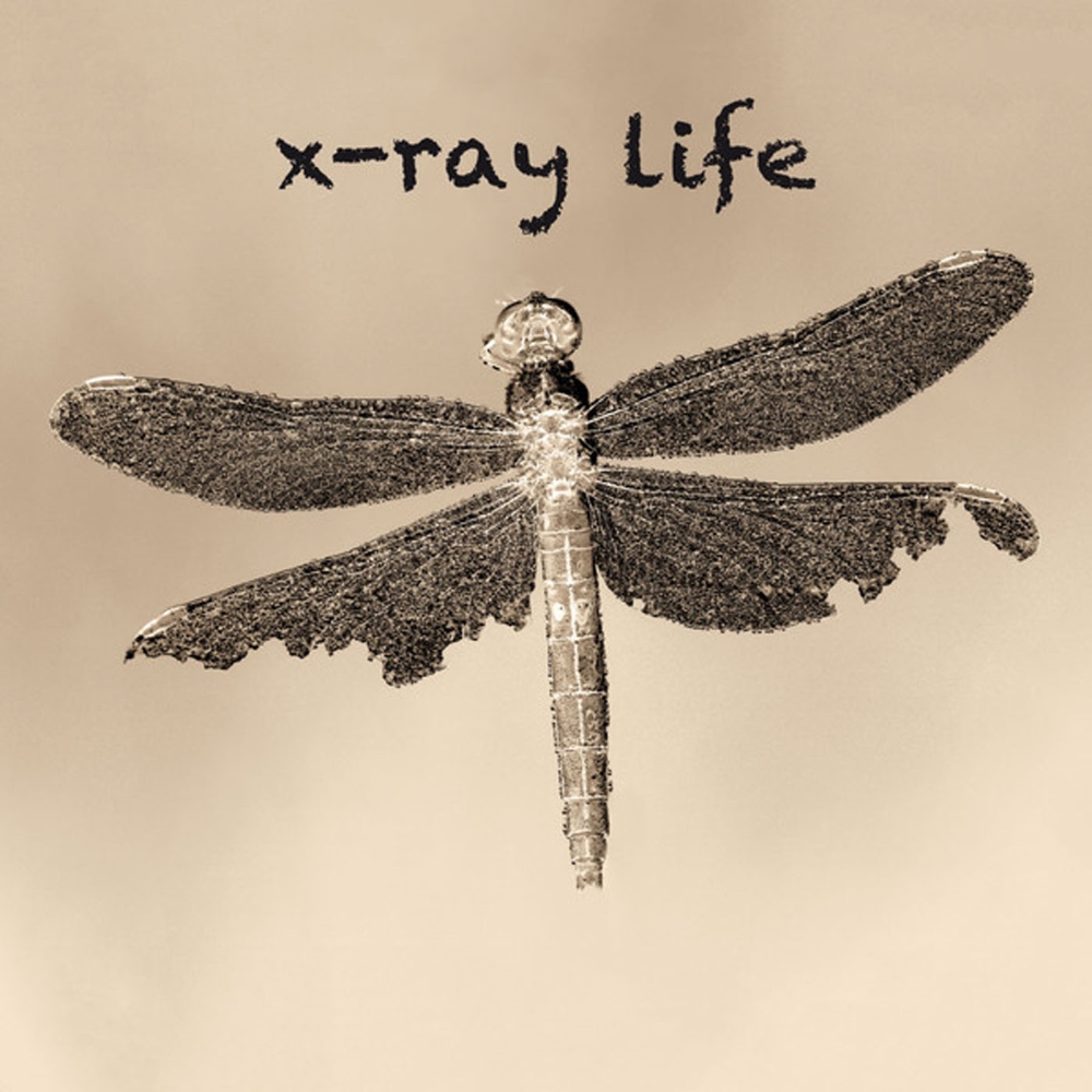X-Ray Life (image for) X-Ray Life
